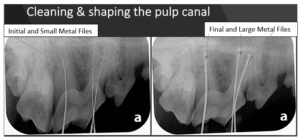 xrays of dog tooth