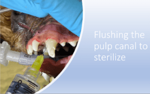 cleaning the root canal